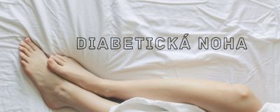 Wie erkennt man einen diabetischen Fuß? | ARNO-schuhe.de – Schuhe mit Tradition