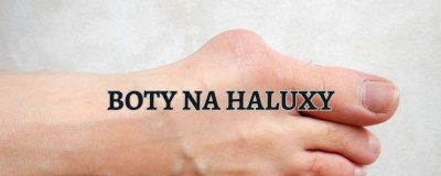 Gesundheitsschuhe für Hallux: Was ist bei der Auswahl wichtig? | ARNO-schuhe.de – Schuhe mit Tradition